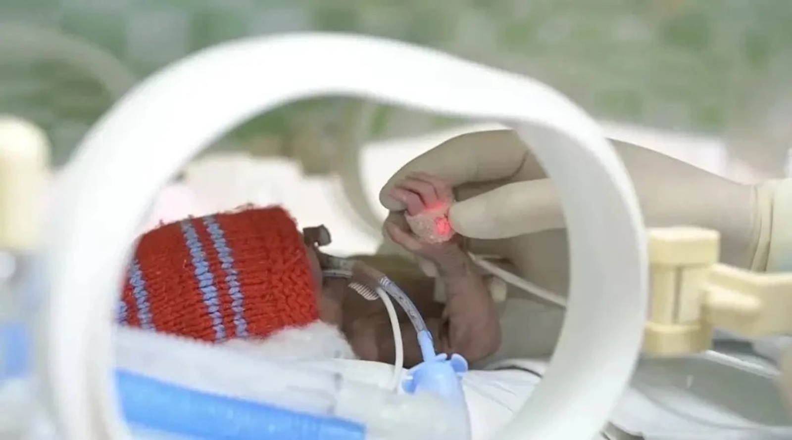 480 грамм булып туган сабый яшәячәк!