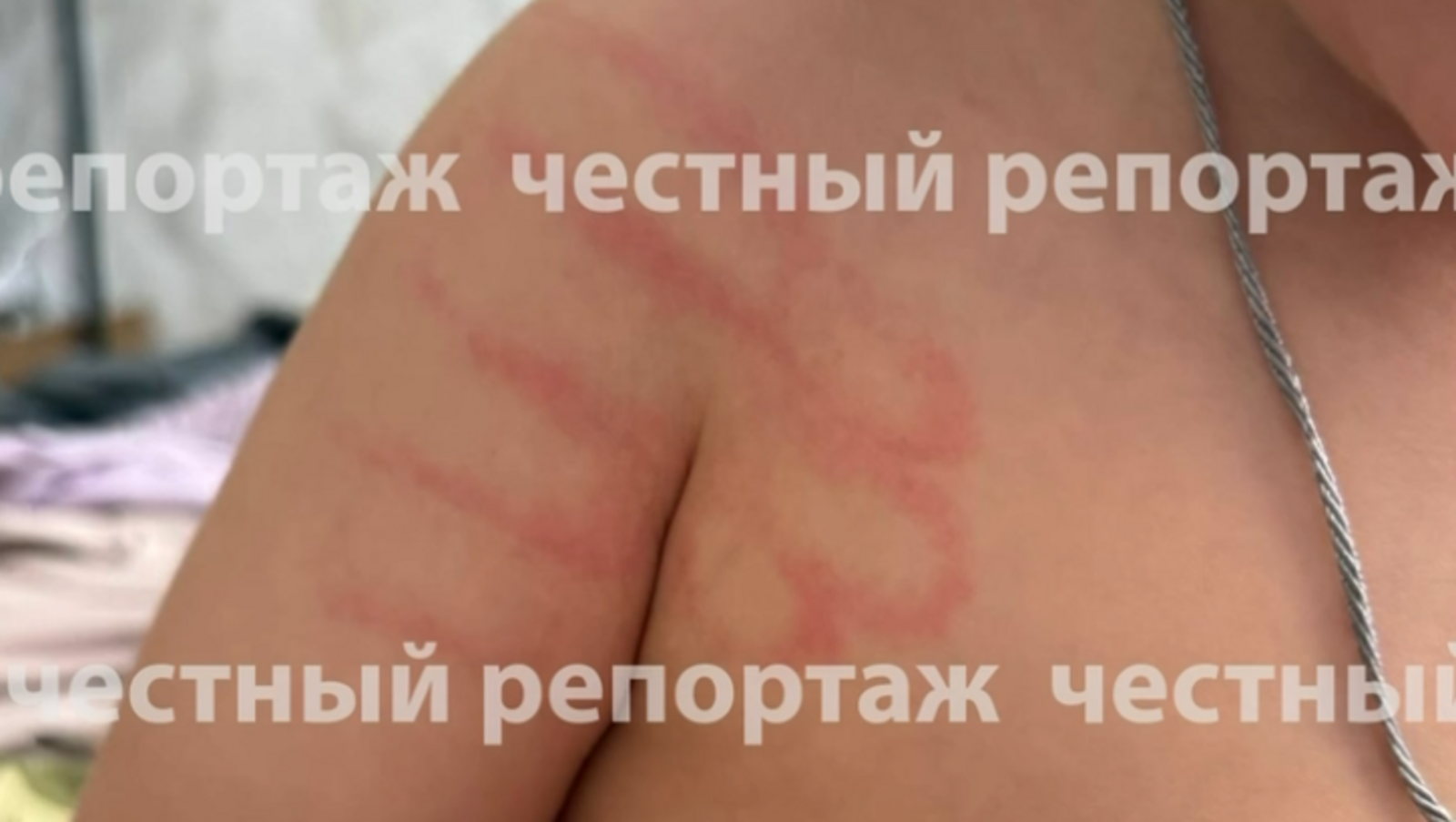 Балалар бакчасында сабыйны кыйнаганнар...