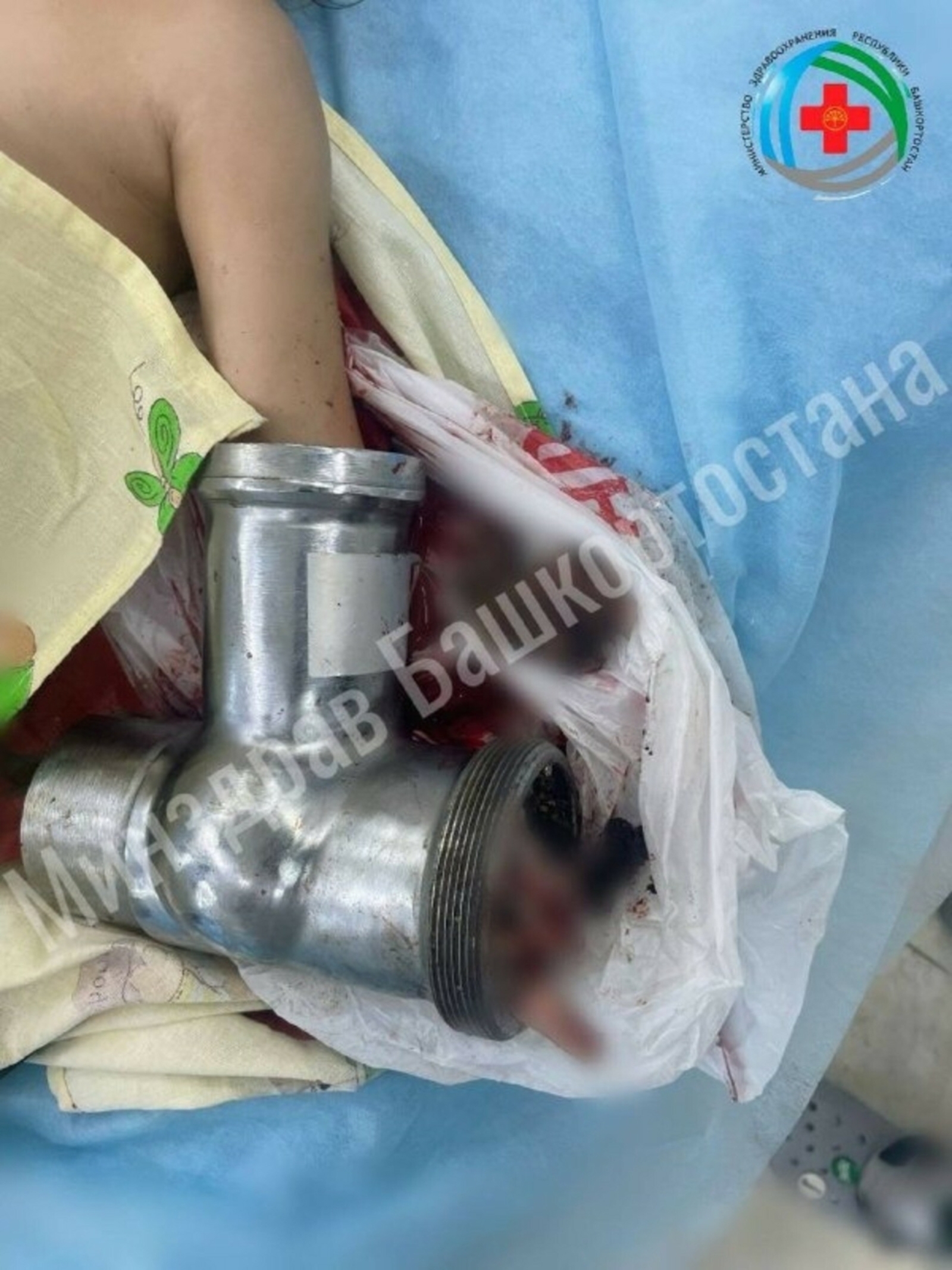 Иттарткычка кулын тыккан