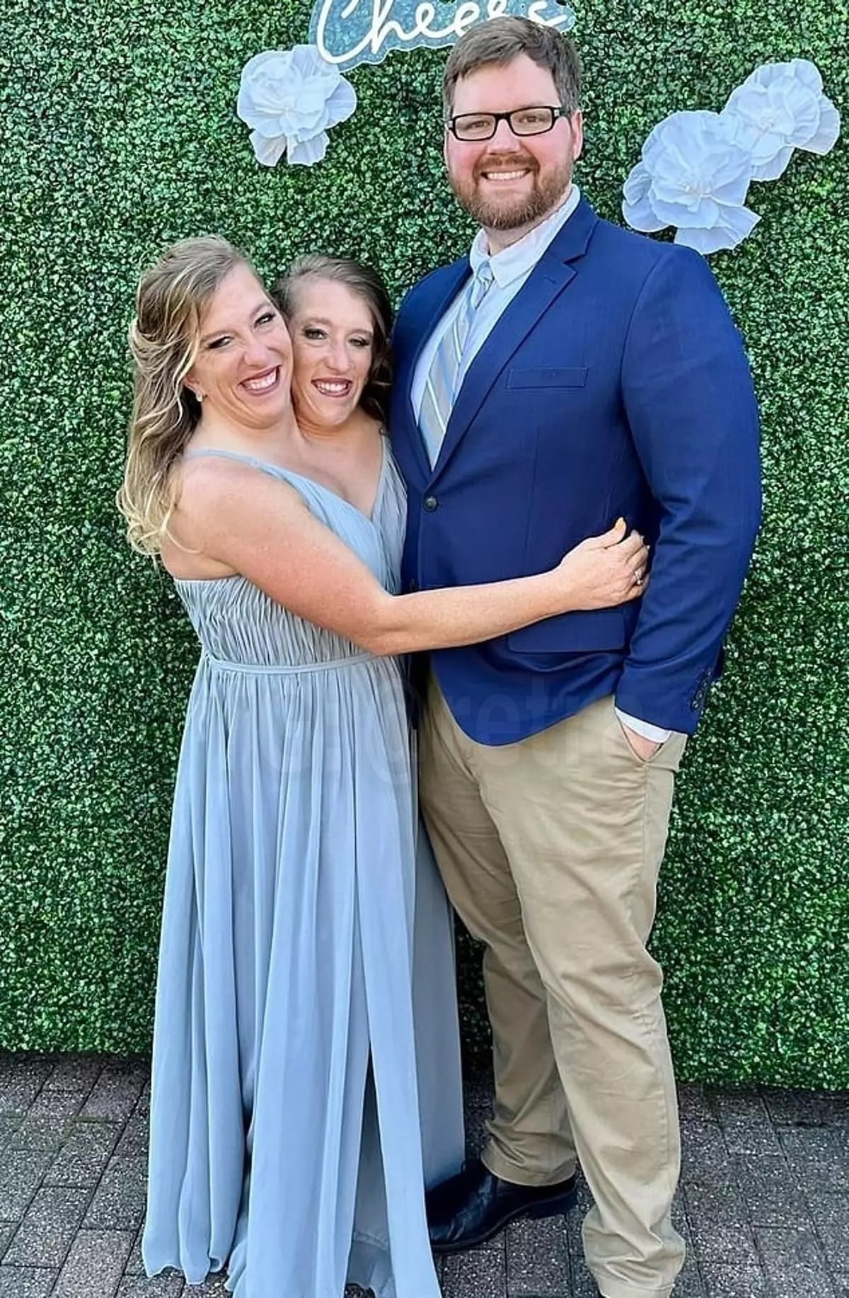 Сиам игезәкләренең баласы бар!